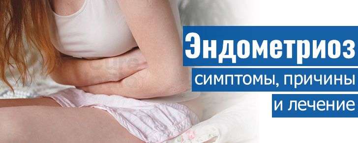 Эндометриоз лечение